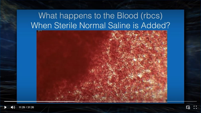 red blood cells with normal saline added